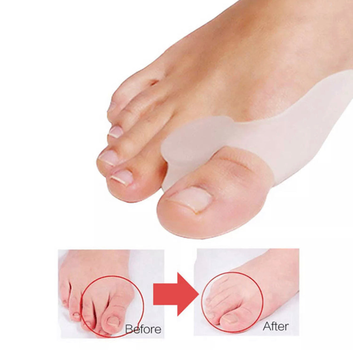 Orthopaedic Gel Toe Bunion Corrector Pain Relief Day and Night Splinter