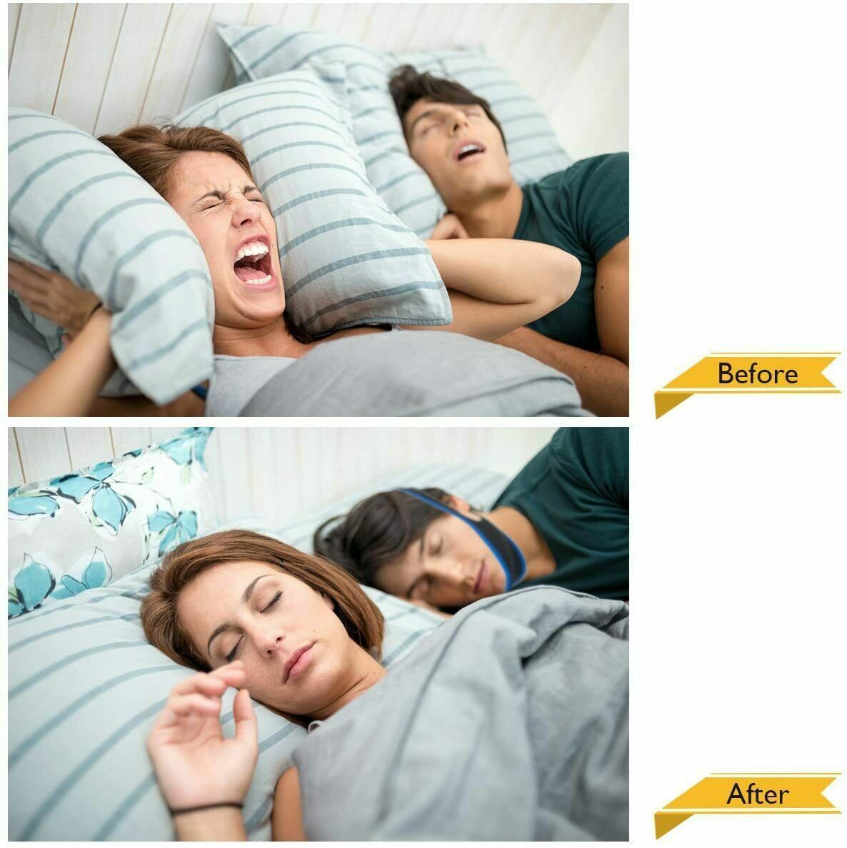 Anti Snoring Chin Strap Sleep Apnea Support