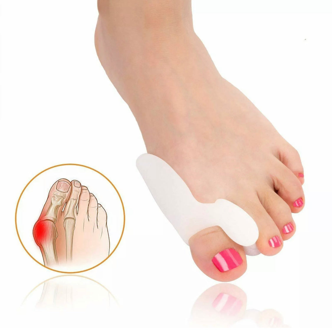 Orthopaedic Gel Toe Bunion Corrector Pain Relief Day and Night Splinter