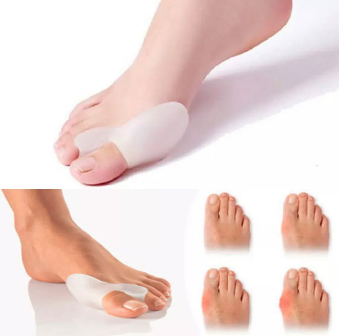 Orthopaedic Gel Toe Bunion Corrector Pain Relief Day and Night Splinter